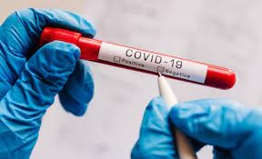 Holanda raporton shifra të larta infektimesh me koronavirus